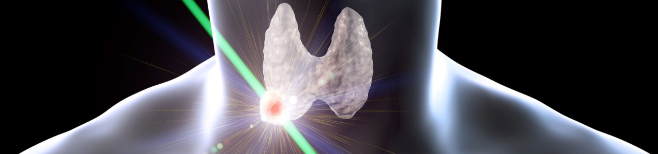 Лазерная деструкция узлов щитовидной железы – так можно?