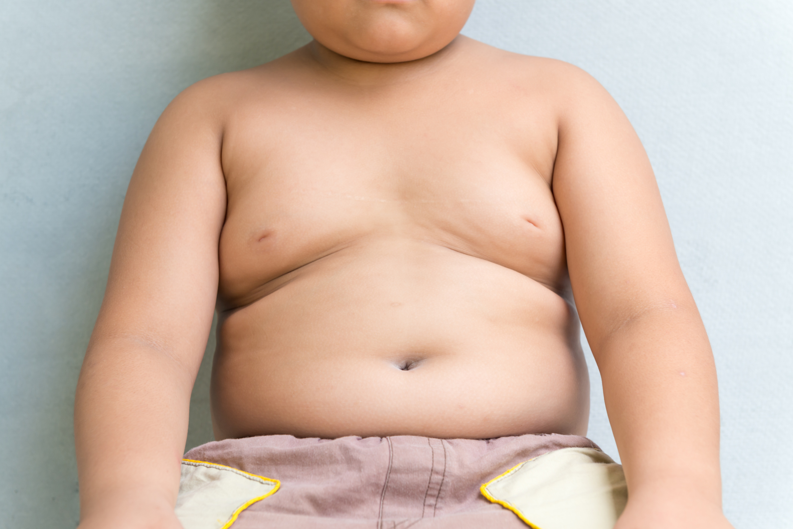 Полненький мальчик. Ожирение у детей и подростков. Дети с СС ожирением.