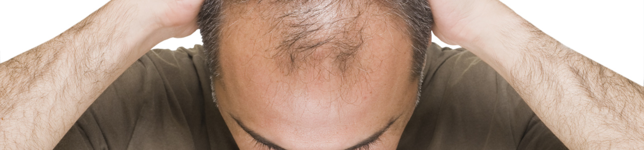 Прорыв в лечении выпадения волос? Индукция микроРНК-205