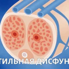 Нарушения половой функции у мужчин. Эректильная дисфункция и её составляющие: дифференциальная диагностика, подходы к терапии
