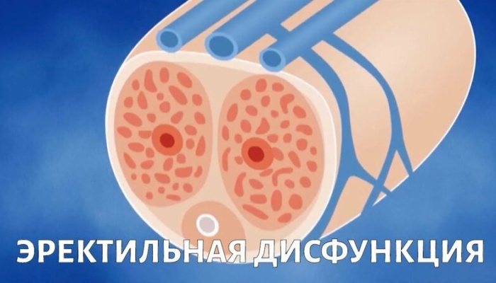 Нарушения половой функции у мужчин. Эректильная дисфункция и её составляющие: дифференциальная диагностика, подходы к терапии