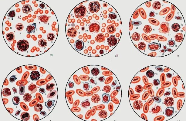 Как расшифровать общий анализ крови