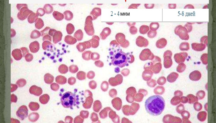 Повышены тромбоциты: реактивный тромбоцитоз vs эссенциальная тромбоцитемия